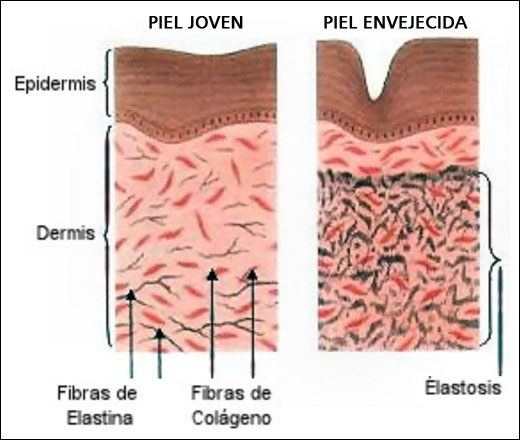 PIEL