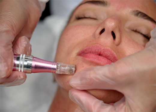 EXOSOMAS Y COSMETICA