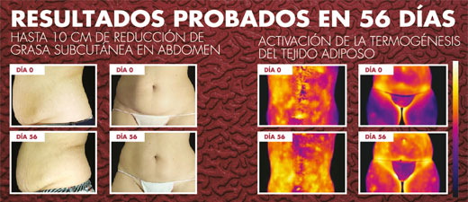 FLAT ABS