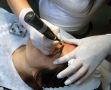 Dermopigmentacin, una solucin efectiva