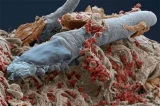 Los ácaros, esas criaturas microscópicas que viven en nuestra cara