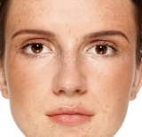 Hiperpigmentación, una consecuencia del exceso de melanina