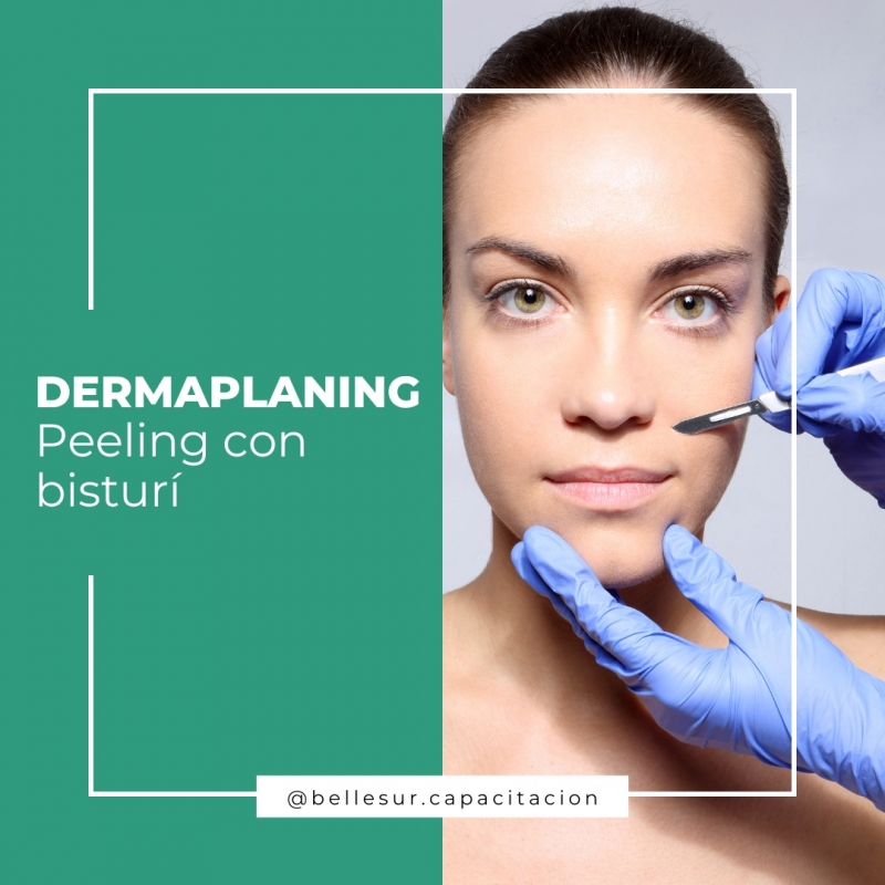 Dermaplaning: peeling con bisturí